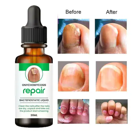 Nail Serum for Repair & Growth - Image 2