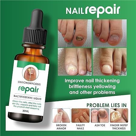 Nail Serum for Repair & Growth - Image 4