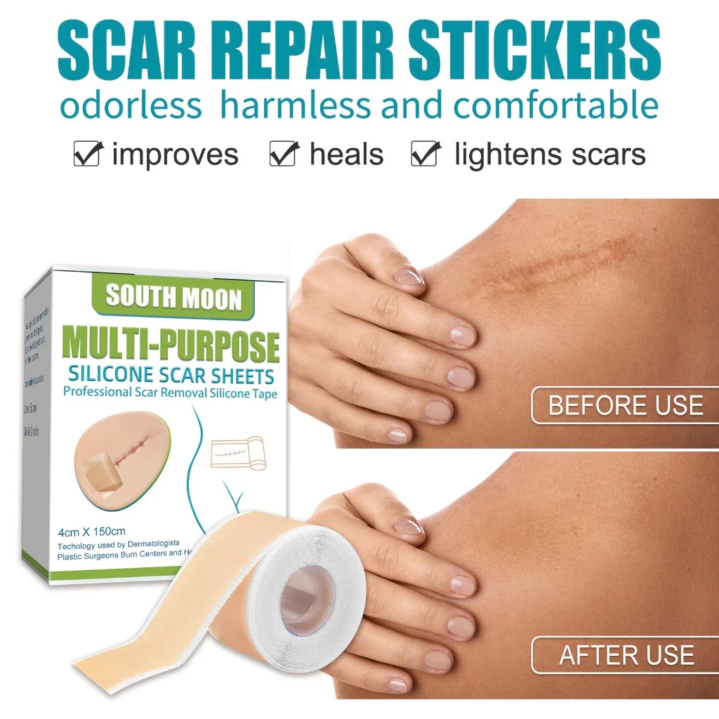 Reusable Medical-Grade Silicone Scar Strips Roll - Image 2