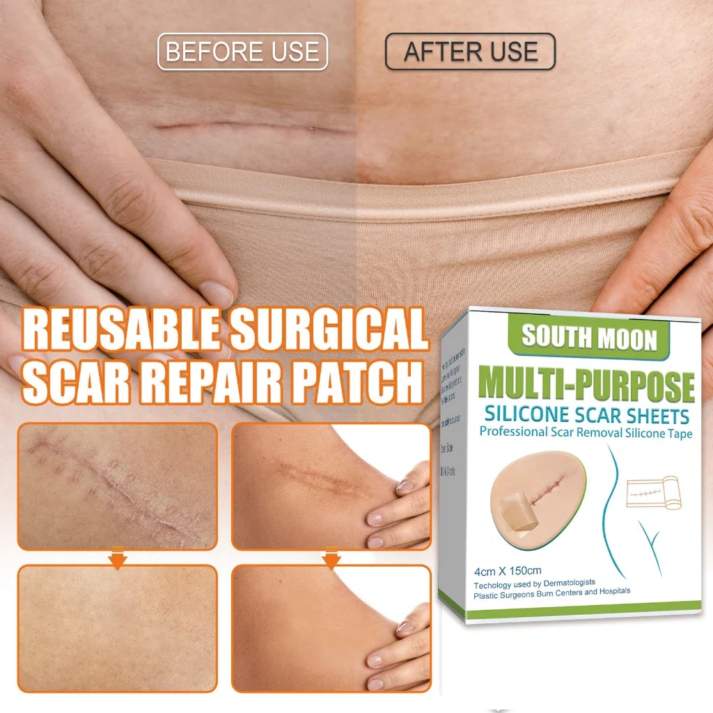 Reusable Medical-Grade Silicone Scar Strips Roll - Image 5